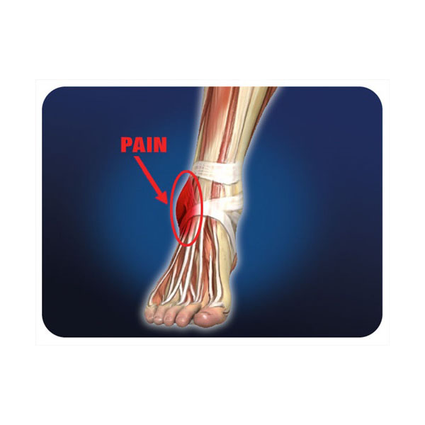 Pro-Tec 3D Flat Premium Ankle Support - Image 2
