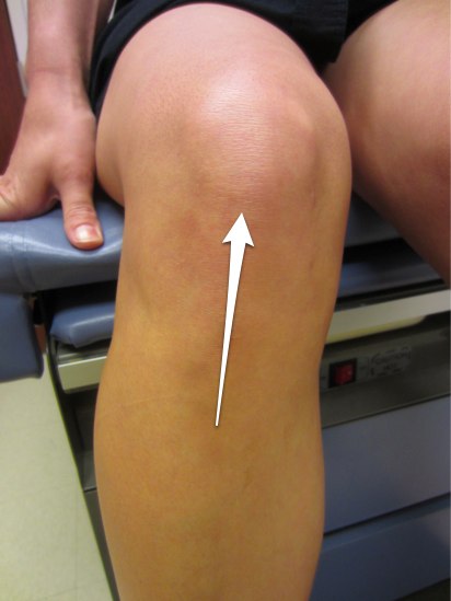 Pro-Tec Gel-Force Knee Support - Image 3