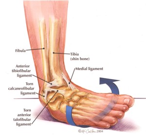 Pro-Tec Gel-Force Ankle Support - Image 3