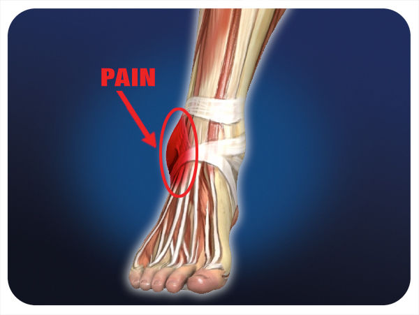 Pro-Tec Gel-Force Ankle Support - Image 4