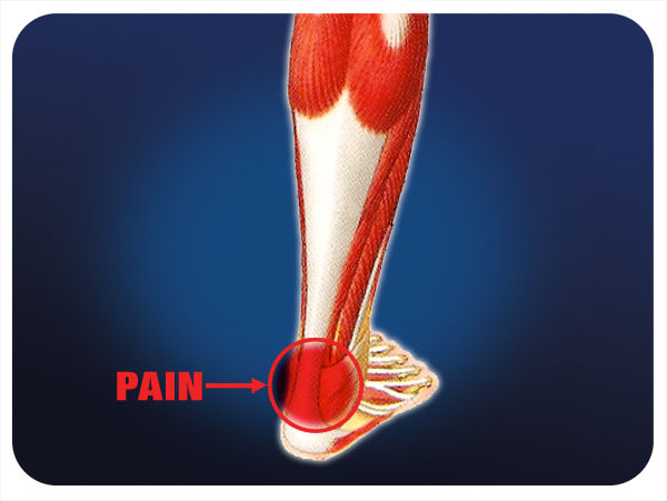 Pro-tec Achilles Tendon Support - Image 2
